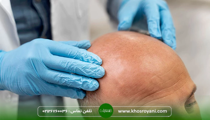 کاندید مناسب روش FIT
