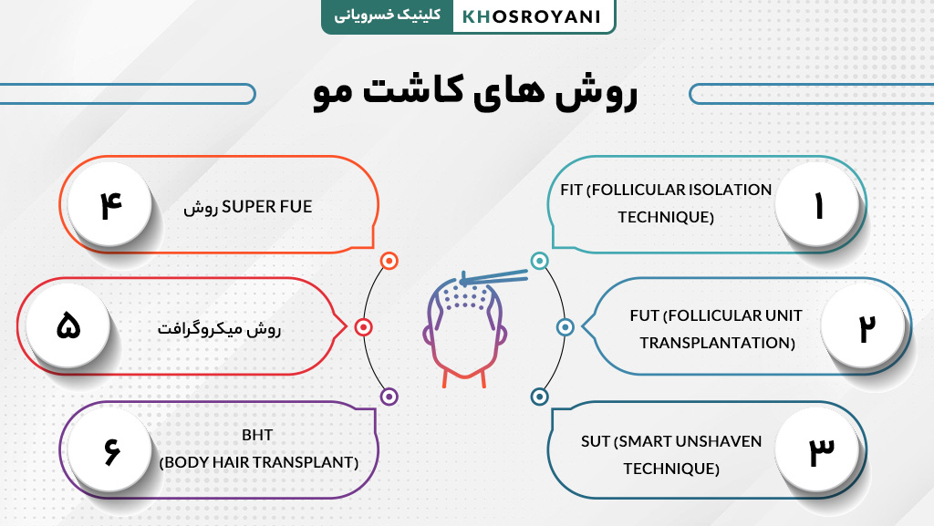 روش های کاشت مو