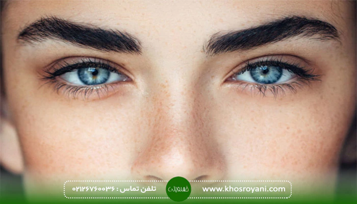 هزینه کاشت ابرو در تهران