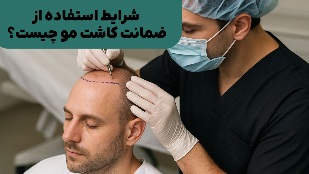 شرایط استفاده از ضمانت کاشت مو چیست؟