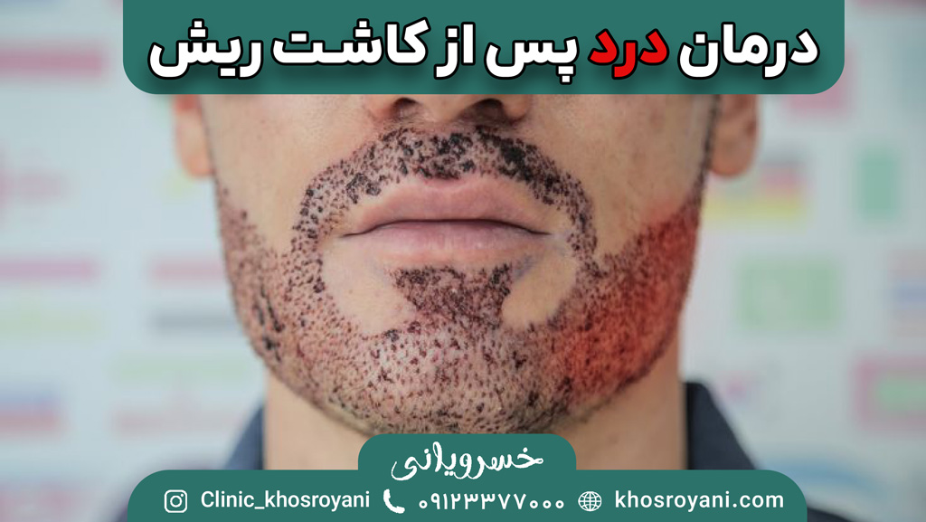درمان درد پس از کاشت ریش