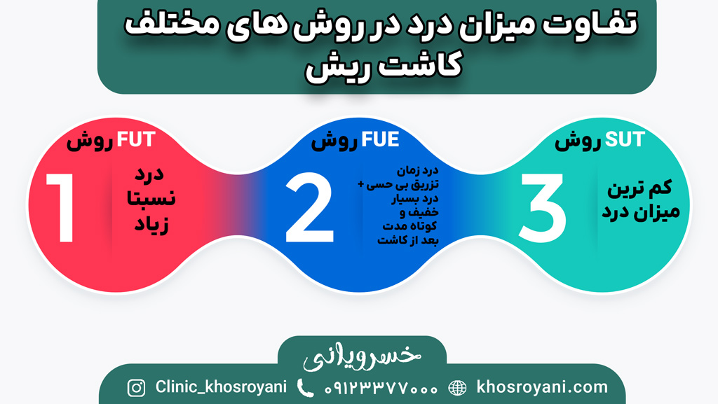 میزان درد در روش های مختلف کاشت ریش