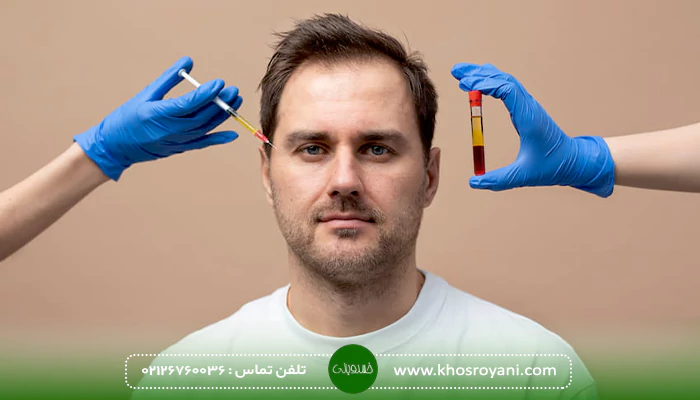 آزمایشات HIV قبل از کاشت مو
