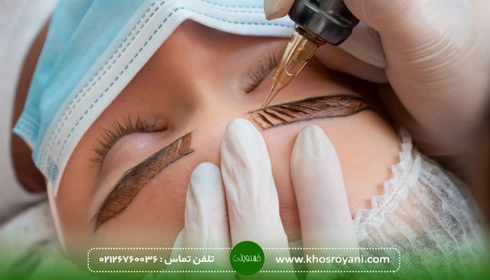 روش های رایج کاشت ابرو در سال ۱۴۰۴