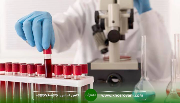برخی دیگر از آزمایشات قبل از کاشت مو