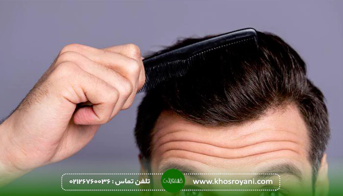 درمان ورم پس از کاشت مو