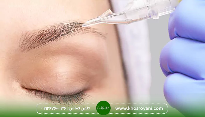 هزینه های جانبی کاشت ابرو