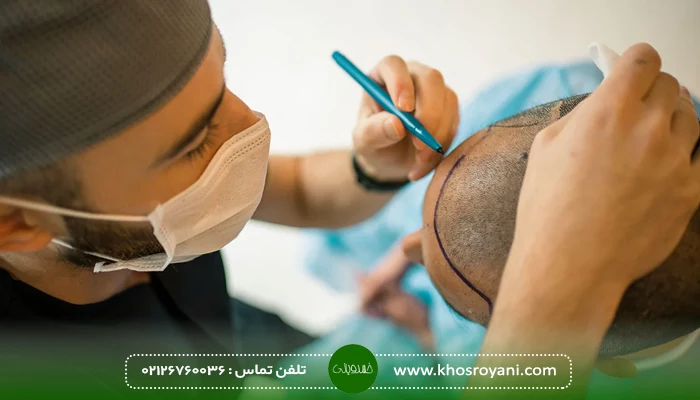مراقبت های لازم بعد از کاشت مو