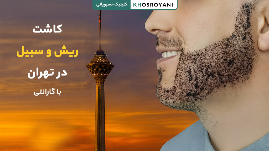 کاشت ریش و سبیل طبیعی توسط متخصص در تهران 