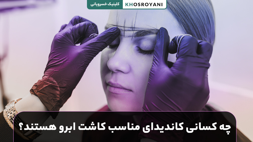 چه کسانی کاندیدای مناسب کاشت ابرو هستند؟