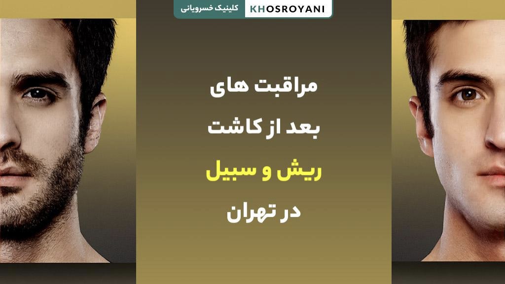 مراقبت های بعد از کاشت ریش و سبیل در تهران