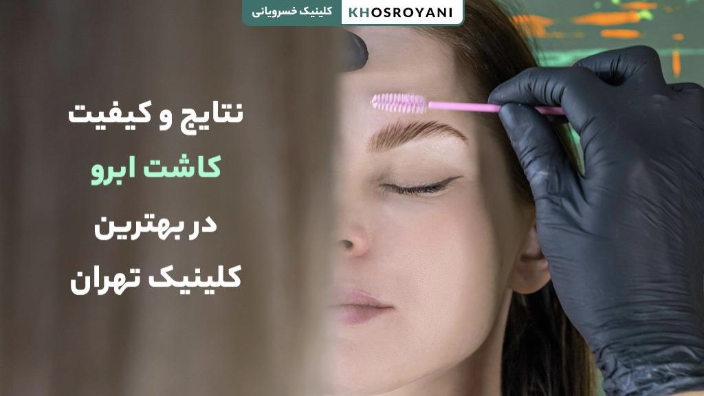 نتایج و کیفیت کاشت ابرو در بهترین کلینیک تهران
