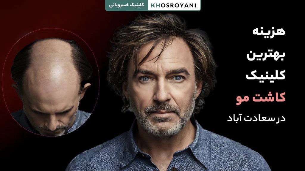 هزینه بهترین کلینیک کاشت مو در سعادت آباد چقدر است؟
