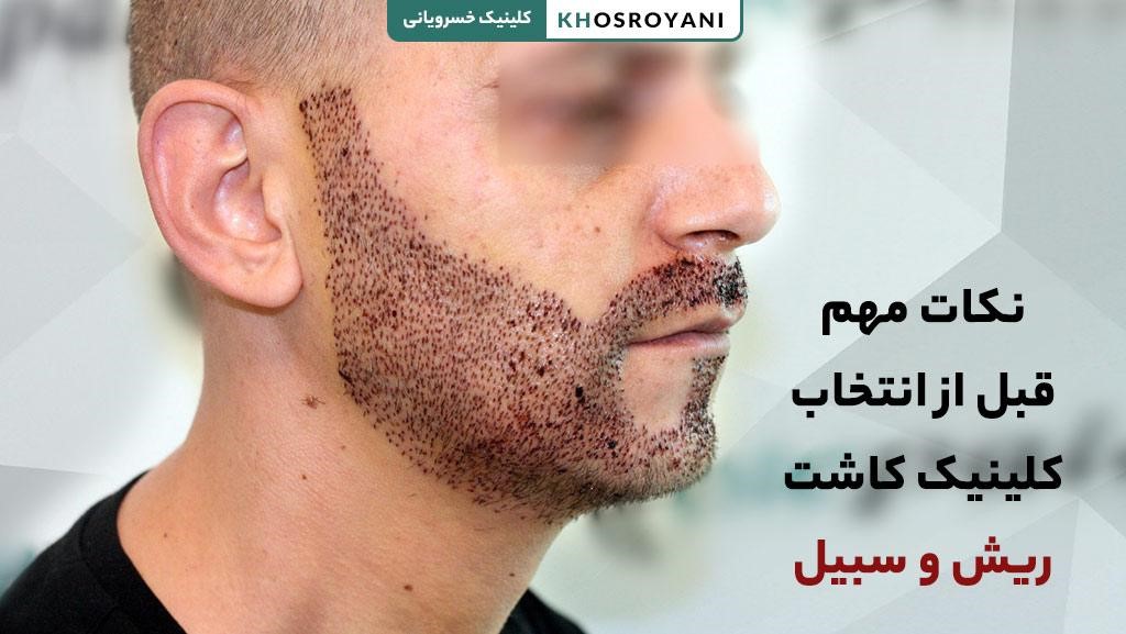 نکات مهم انتخاب کلینیک کاشت ریش 