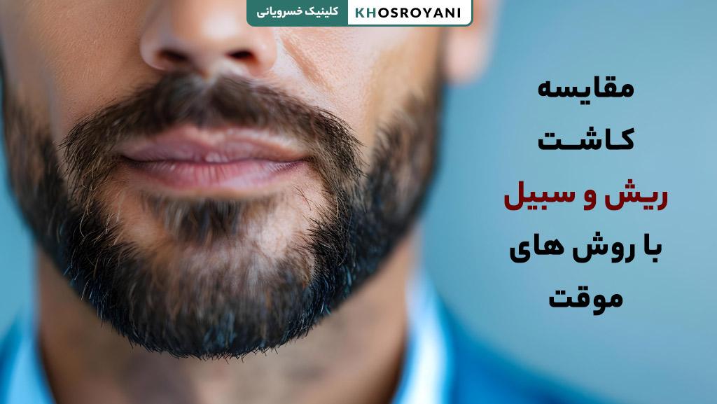 مقایسه کاشت ریش و سبیل با روش های موقت