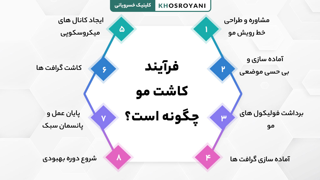 فرآیند کاشت مو چگونه است؟