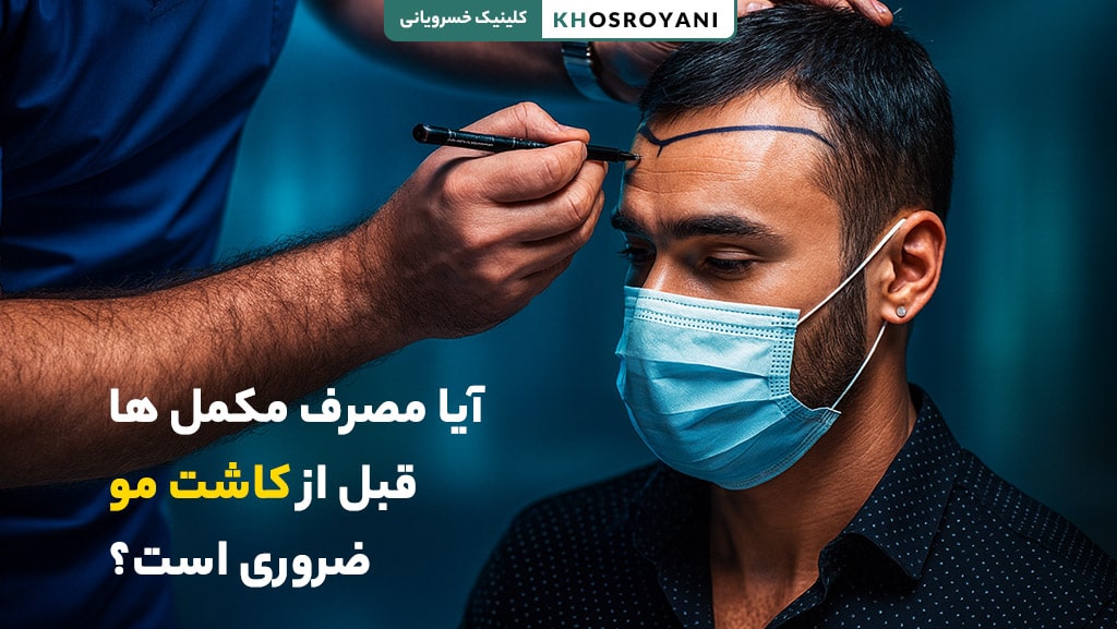 آیا مصرف مکمل ها قبل از کاشت مو ضروری است؟