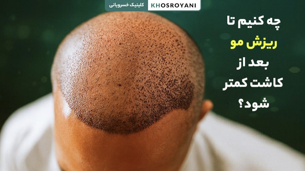 چه کنیم تا ریزش مو بعد از کاشت کمتر شود؟