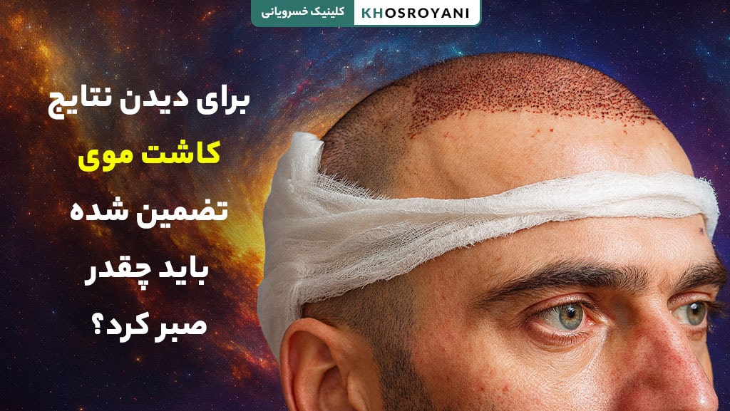 نتایج کاشت مو کی مشخص میشود؟