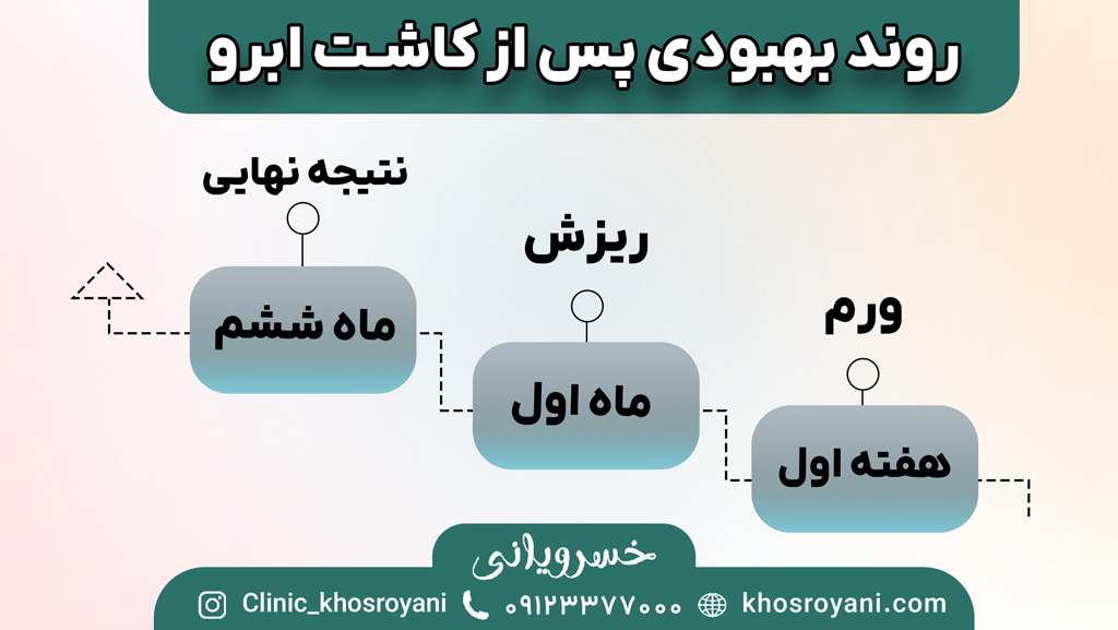 روند بهبودی بعد از کاشت ابرو