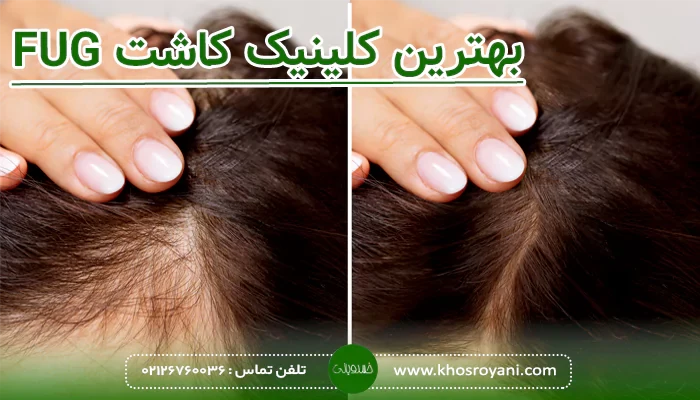 بهترین کلینیک کاشت FUG