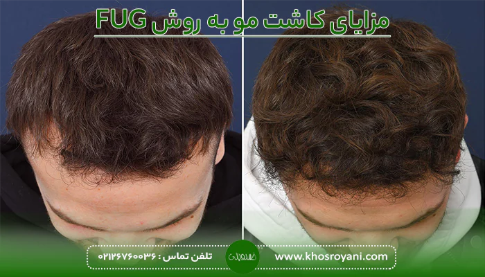 مزایای روش FUG