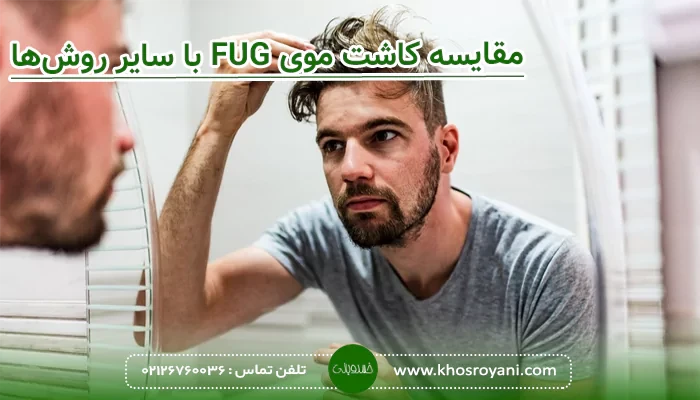 مقایسه کاشت موی FUG با سایر روش‌ها