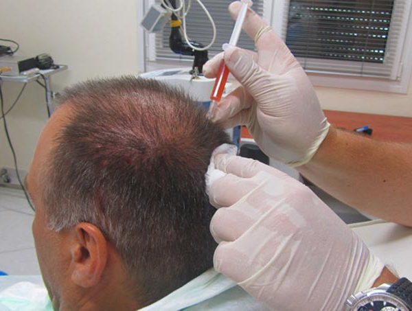 خدمات تقویت مو در کلینیک دکتر خسرویانی