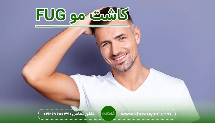 کاشت مو FUG