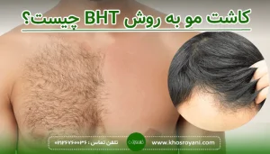 کاشت مو به روش BHT چیست؟