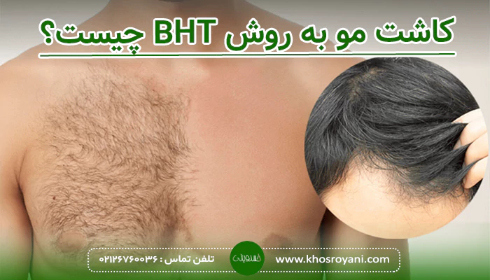 کاشت مو به روش BHT چیست؟