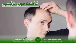 کاشت موی ترکیبی