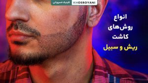 انواع روش‌های کاشت ریش و سبیل + بهترین تکنیک‌ها