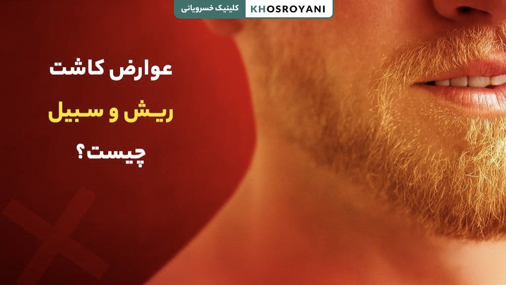 عوارض کاشت ریش و سبیل چیست؟ [ مراقبت‌ها و راه‌های پیشگیری]