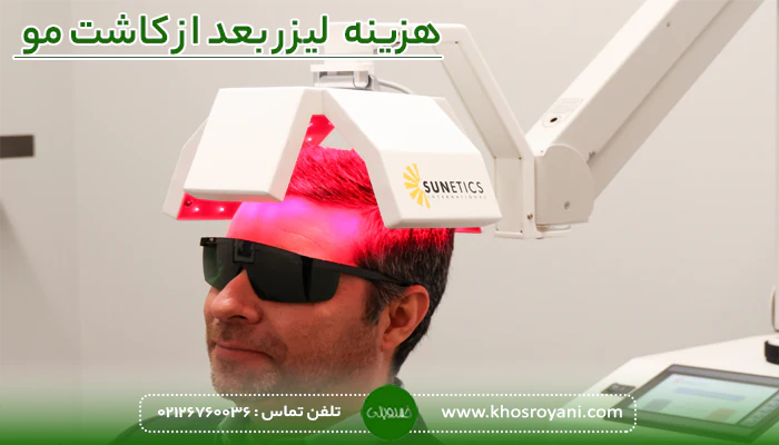 هزینه لیزر تراپی بعد از کاشت مو
