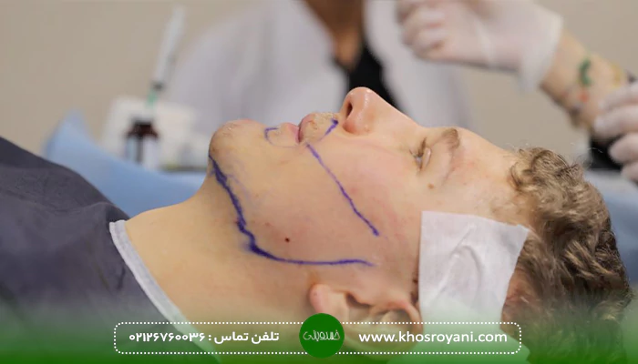 چرا کاشت ریش و سبیل برای آقایان اهمیت دارد؟