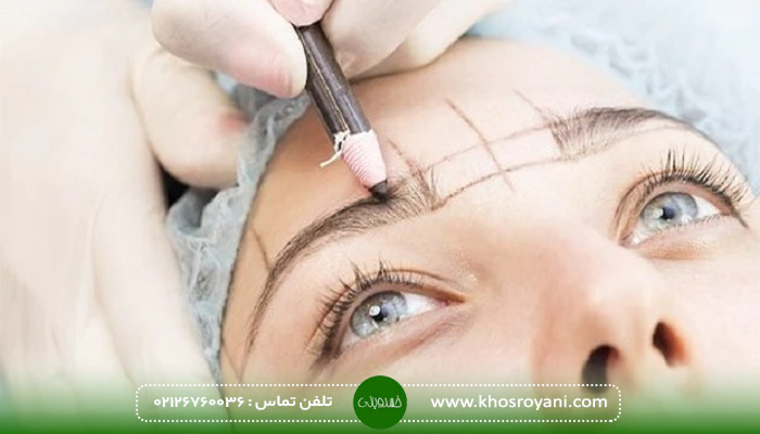 مراقبت های بعد از کاشت ابرو