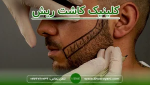 کلینیک کاشت ریش