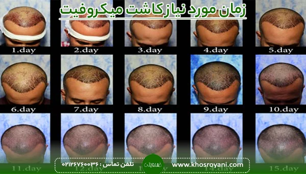 زمان مورد نیاز کاشت میکروفیت