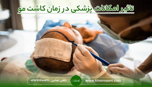 تاثیر امکانات پزشکی بر زمان کاشت مو