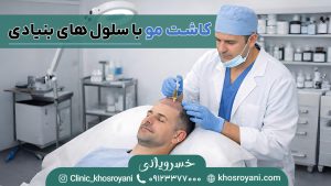کاشت مو به روش سلول های بنیادی