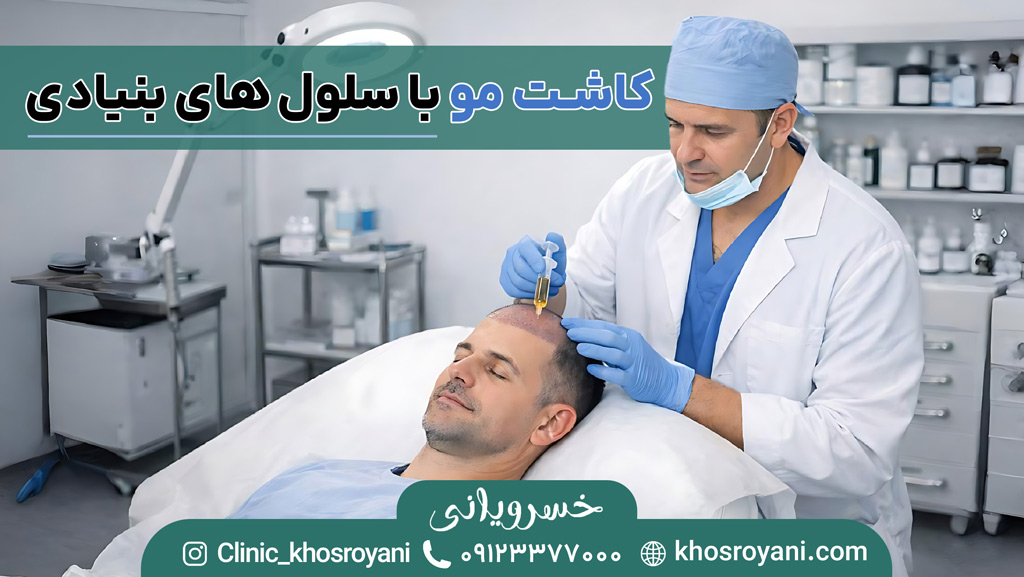 کاشت مو به روش سلول های بنیادی