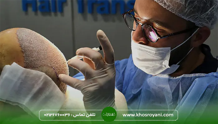 کاشت مو بدون بانک مو برای چه افرادی مناسب است؟