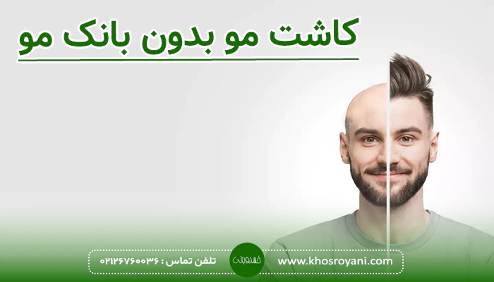 کاشت مو بدون بانک مو