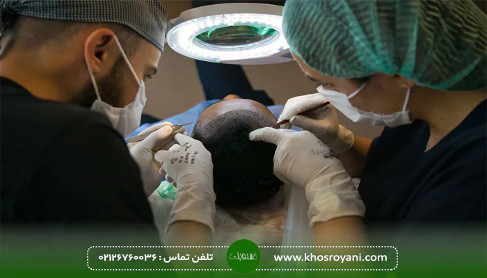 هزینه کاشت مو بدون بانک مو