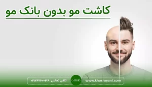 کاشت مو بدون بانک مو