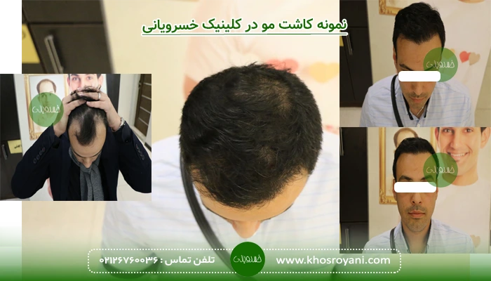 نمونه 5
