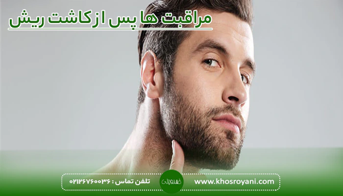 مراقبت ها پس از کاشت ریش