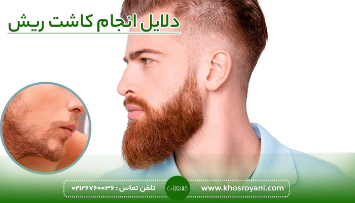 دلایل انجام کاشت ریش