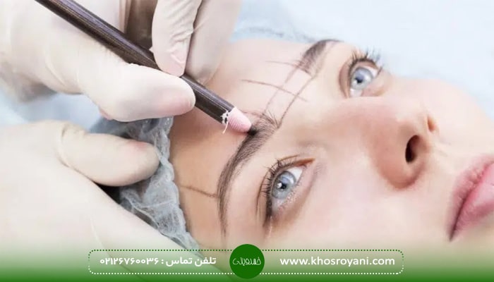 معایب کاشت ابرو سعادت آباد